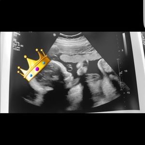 Meet your Posher, Anahi